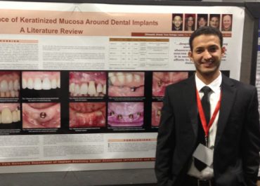 The Survival Rate of RBM Surface Versus SLA Surface in Geometrically Identical – Implant Design